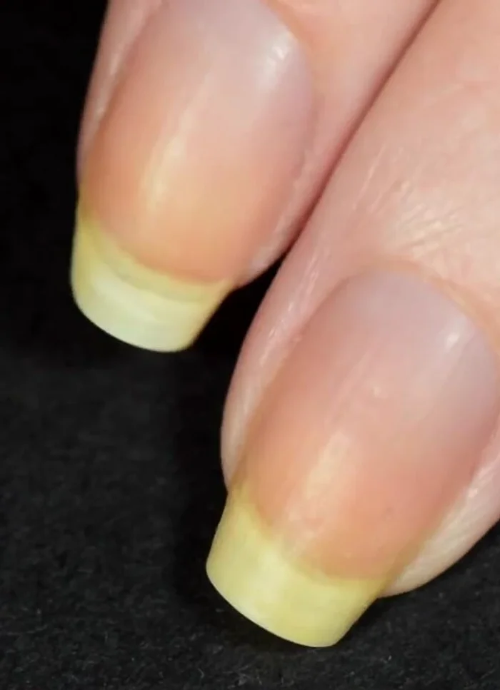 Dehydrate your nails with rubbing alcohol, nail polish remover, or acetone.