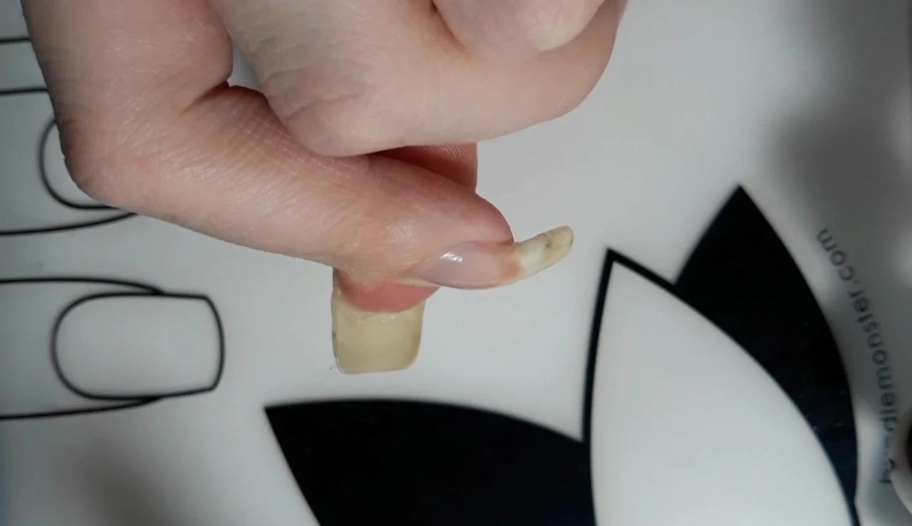 Broken nail repair: before gel application.