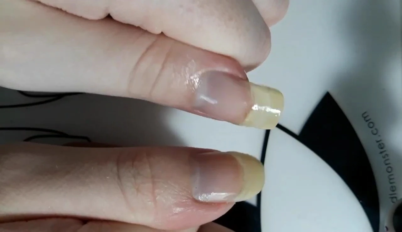 Broken nail repair with gel topcoat