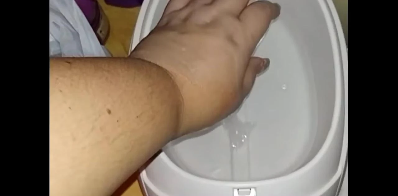 Hands covered in solidified paraffin wax