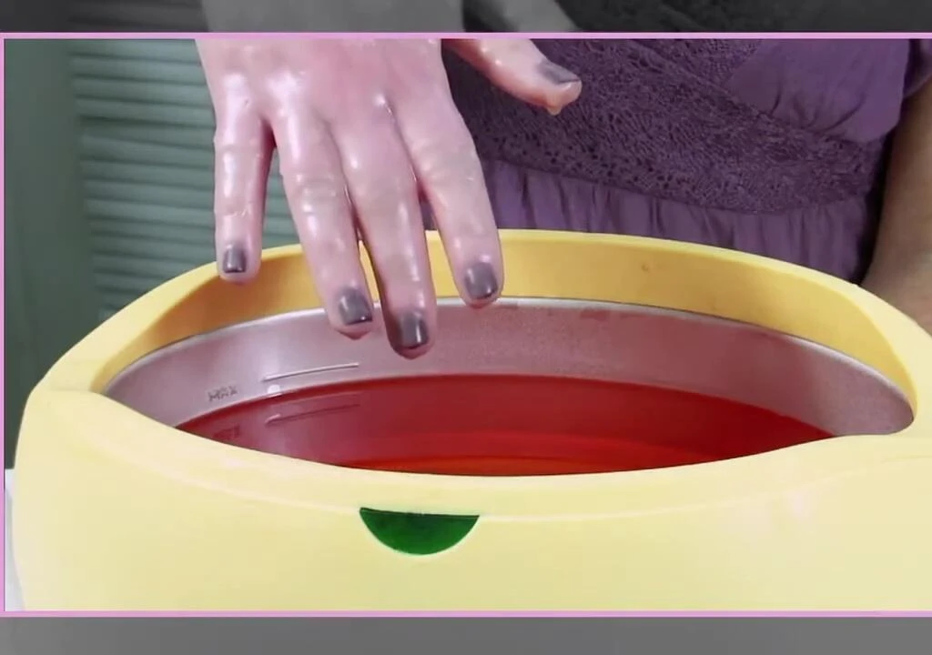 Multiple layers of paraffin wax applied to the hands.