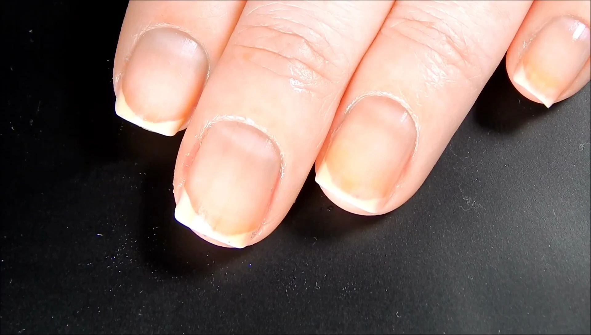 The reviewer's hands after removing the nail polish.