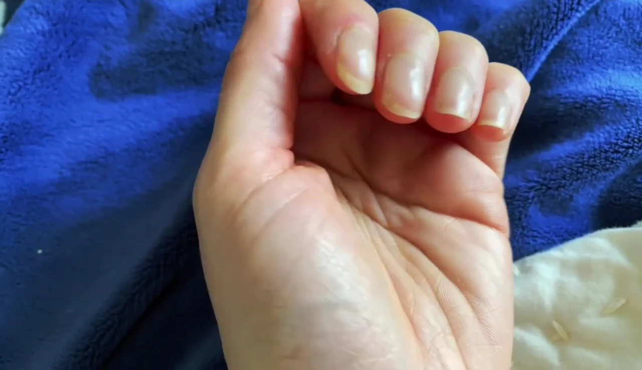 The condition of nails three days after applying OPI Nail Envy.