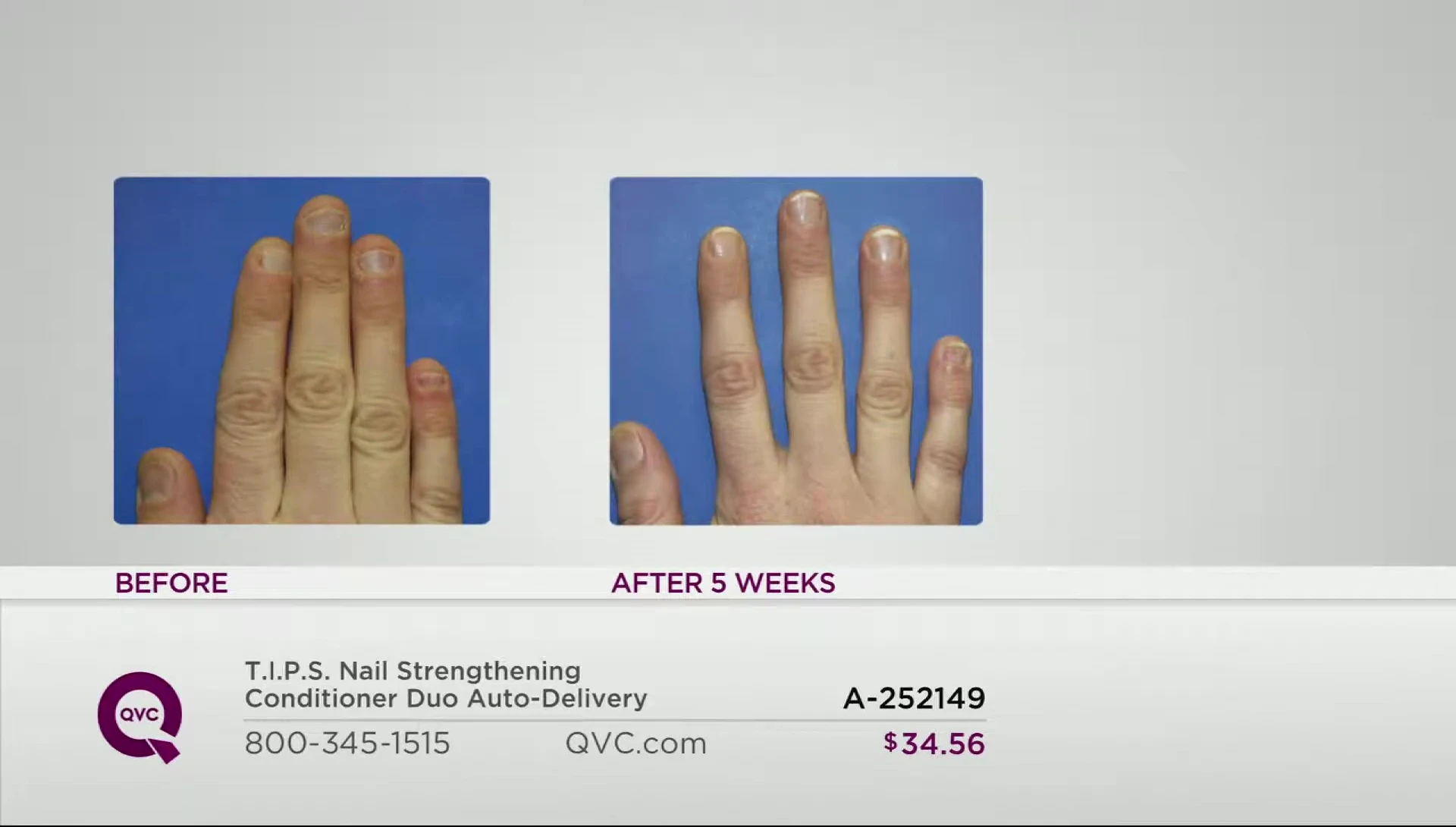 Before and after images comparing the nail condition before and after using T.I.P.S.