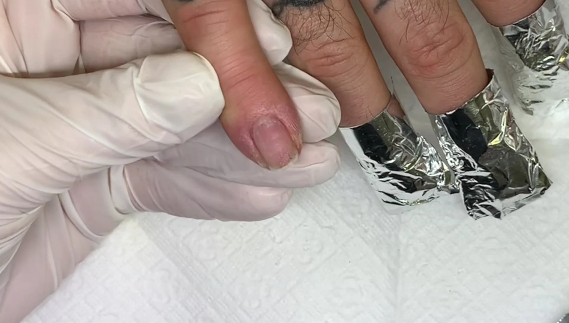 The easy removal process is shown