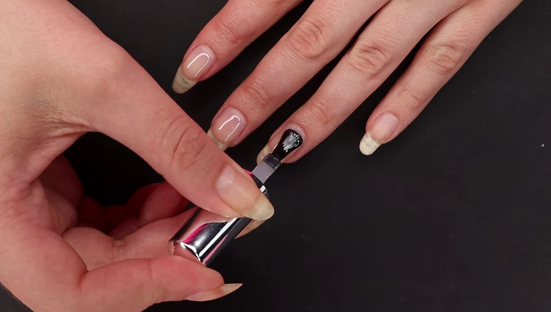 Showing the apex of the thumb nail after curing