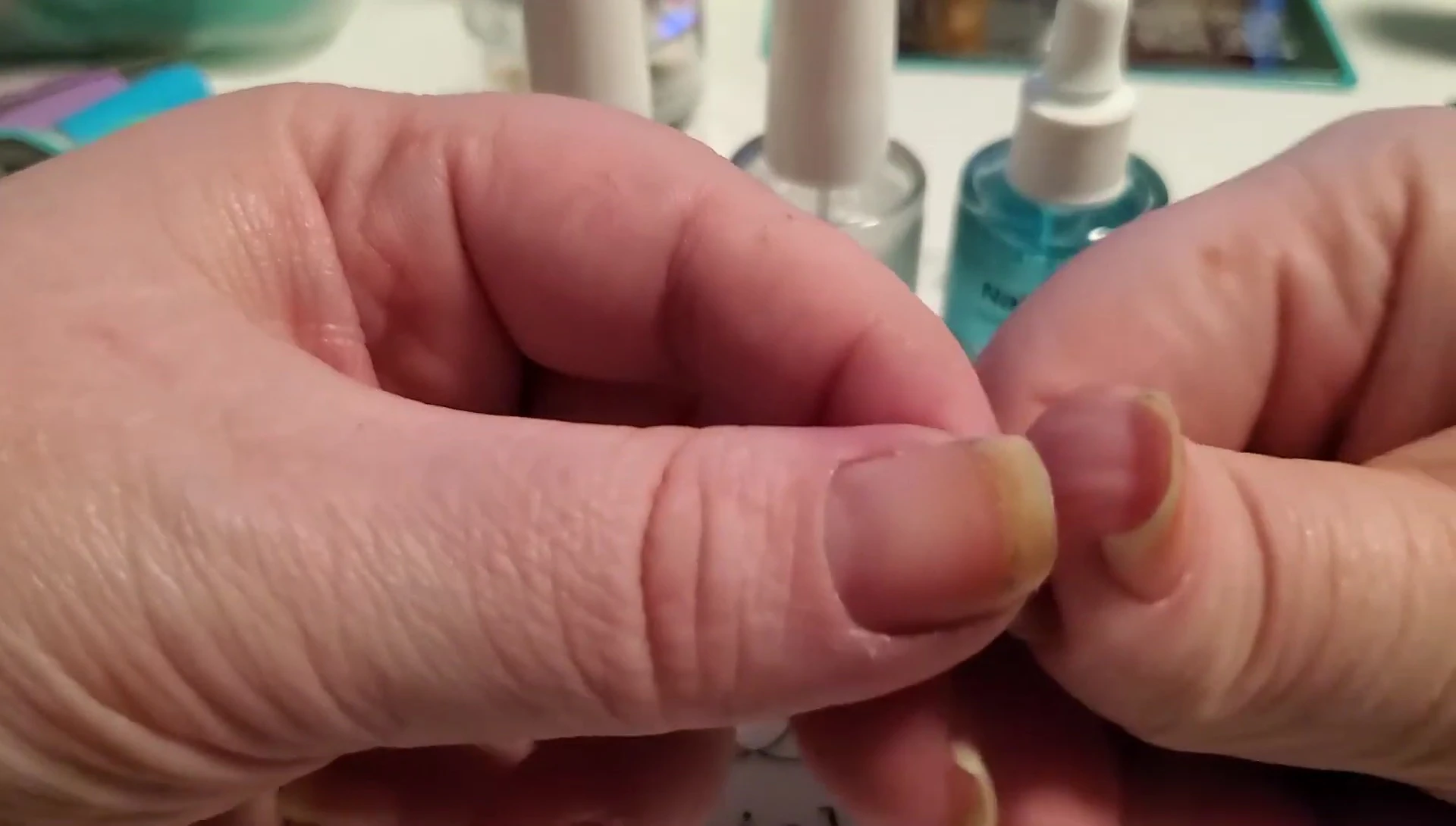 Image showcasing thicker and healthier-looking nails after treatment.