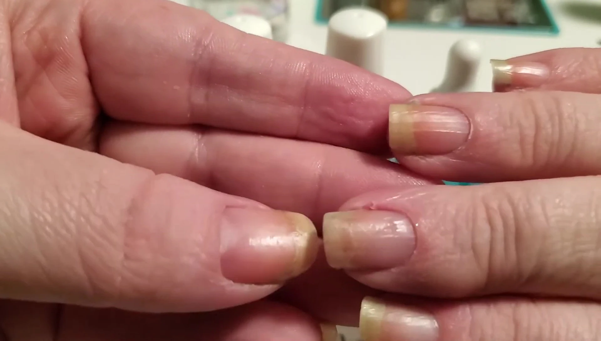Chipped nails before repair