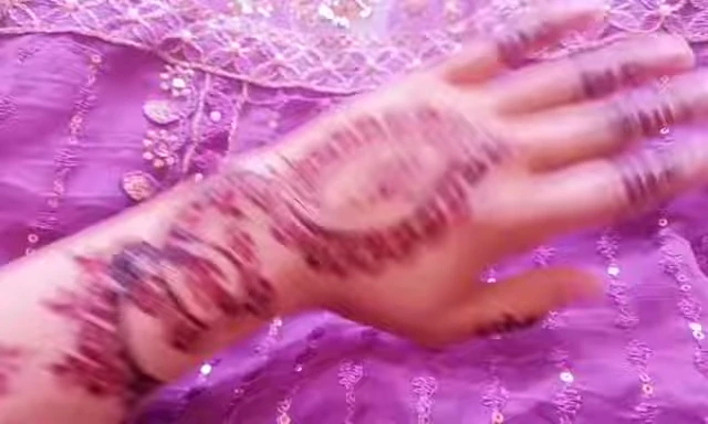 A shot illustrating that the stickers were also used on feet.